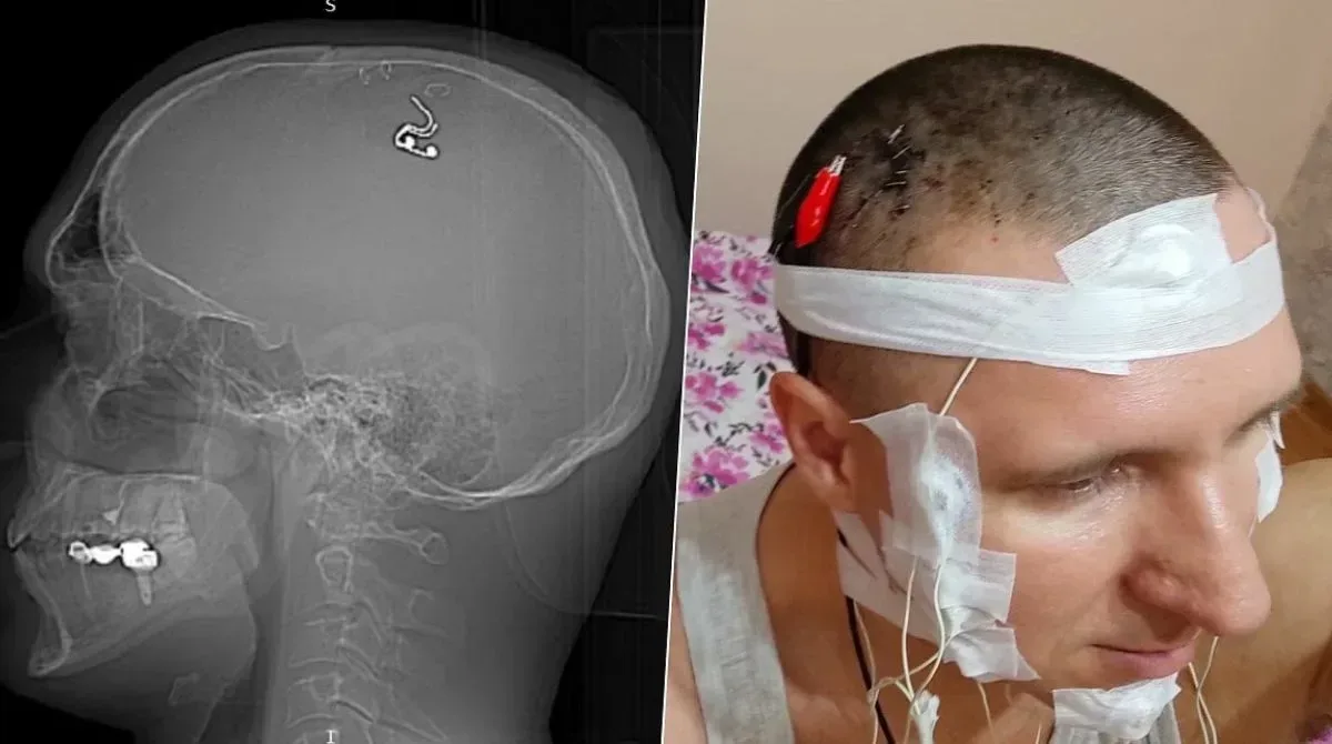 Surgery jpg webp webp Surgery jpg webp webp