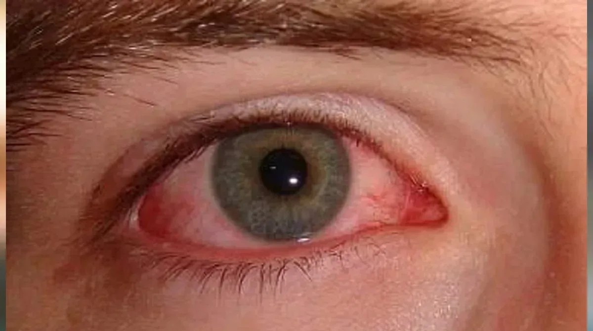 dole jpg webp webp dole jpg webp webp