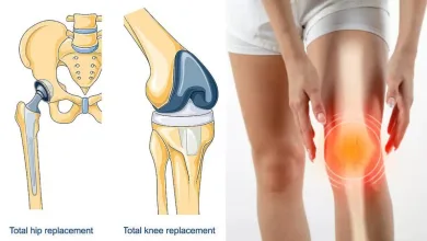 knee surgery