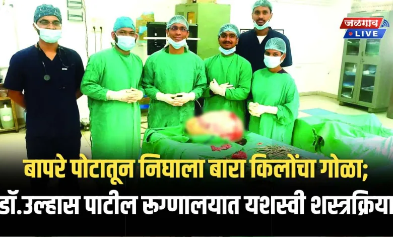 बापरे पोटातून निघाला बारा किलोंचा गोळा; डॉ.उल्हास पाटील रूग्णालयात यशस्वी शस्त्रक्रिया 1 GH